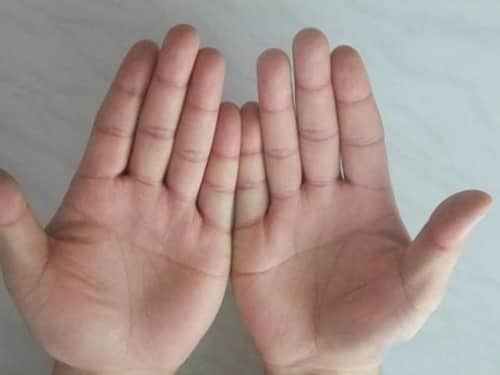 Tướng người không nên kết thân